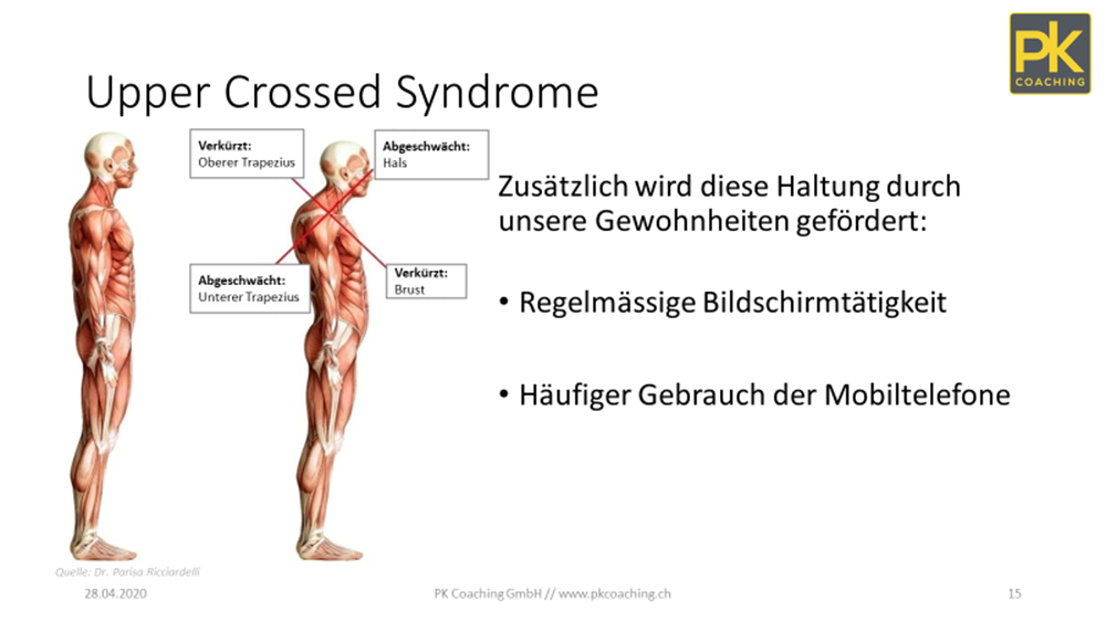 Syndrome